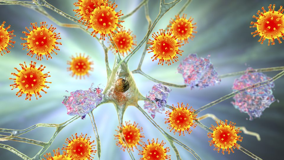 Ilustrasi konseptual tentang virus yang menginfeksi neuron dan kerusakan progresif pada fungsi otak, plak amiloid di jaringan otak.