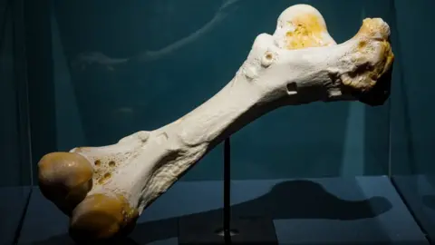 Pameran 'Tulang' di Museum Medis Thackray